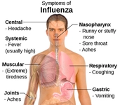 Zatürre Bulaşıcı mıdır? Zatürre Bulaşıcı mıdır?