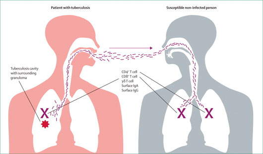 Zatrre Nasl Bular